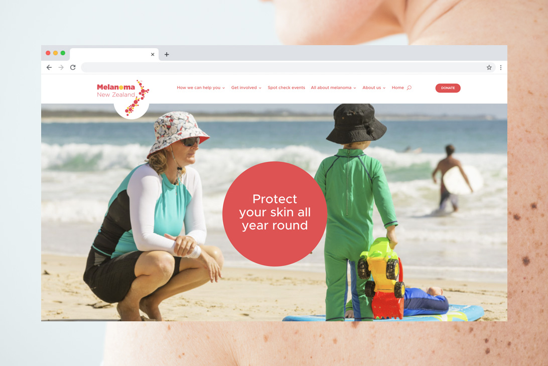 Melanoma New Zealand website